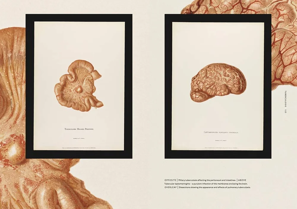 The Sick Rose Disease and the Art of Medical Illustration /anglais