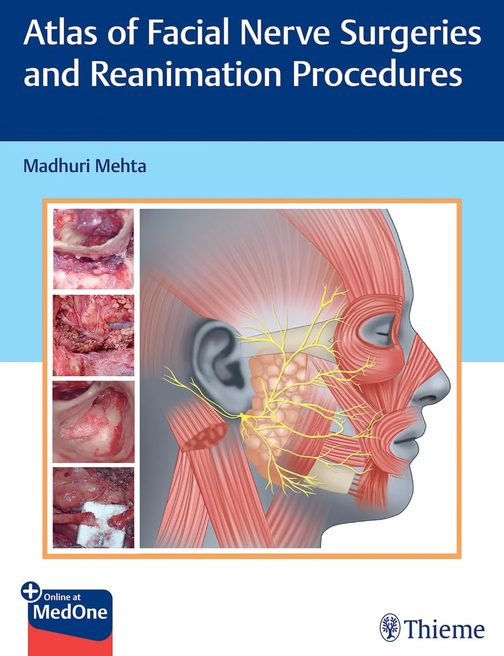 Atlas of Facial Nerve Surgeries and Reanimation Procedures