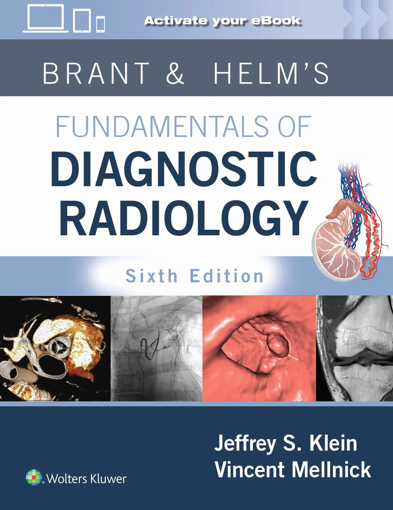 Brant & Helms' Fundamentals of Diagnostic Radiology: Print + eBook with Multimedia
