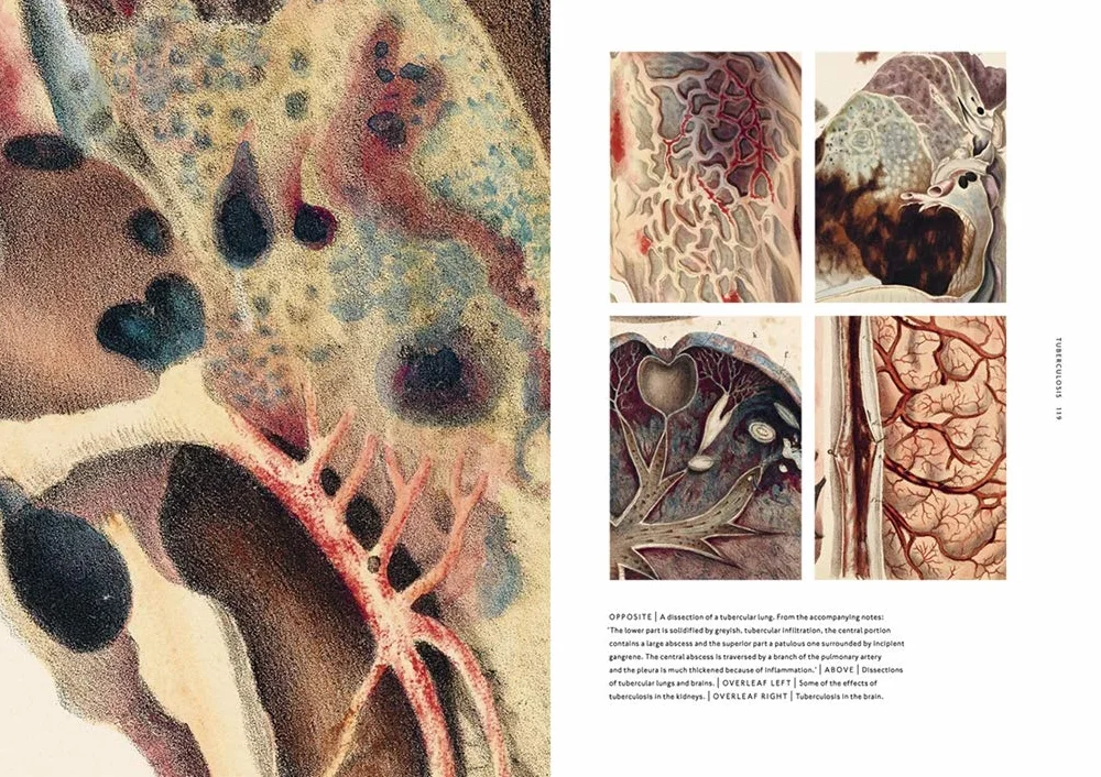 The Sick Rose Disease and the Art of Medical Illustration /anglais