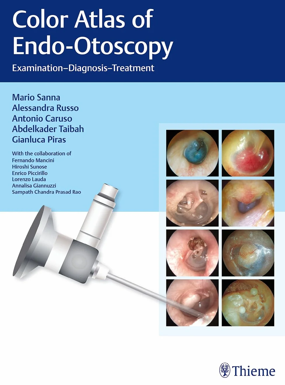 Color Atlas of Endo-Otoscopy: Examination - Diagnosis - Treatment