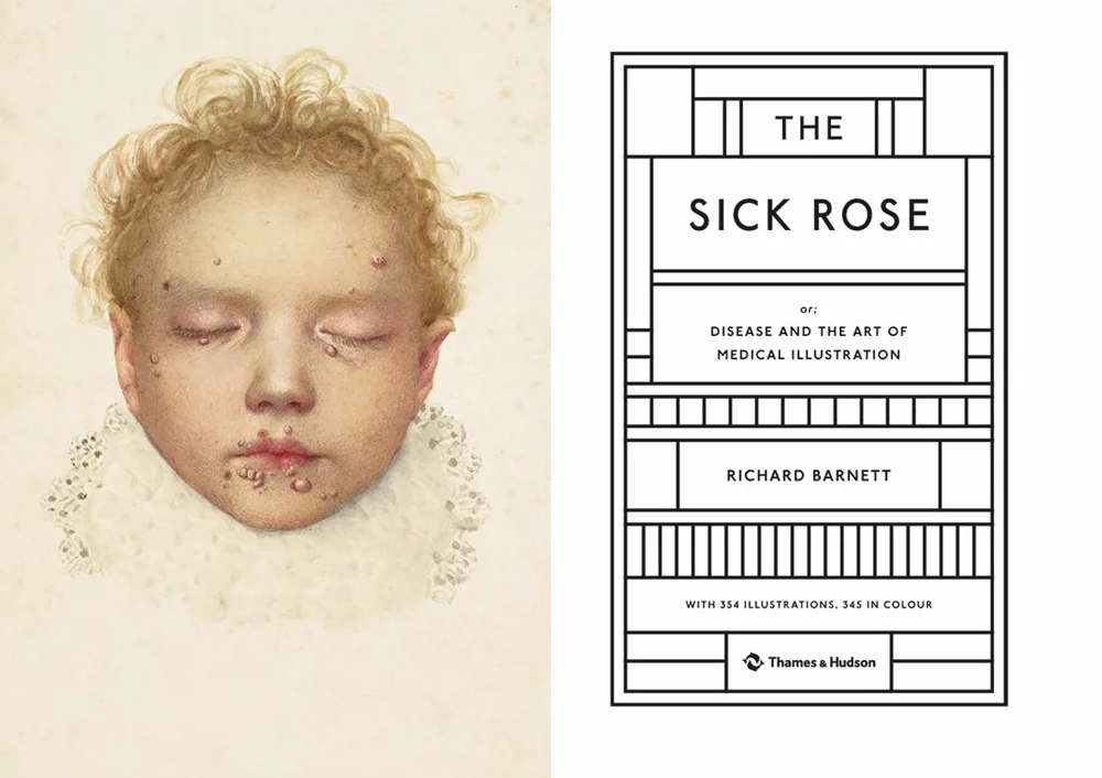 The Sick Rose Disease and the Art of Medical Illustration /anglais