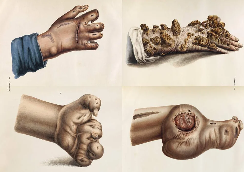 The Sick Rose Disease and the Art of Medical Illustration /anglais