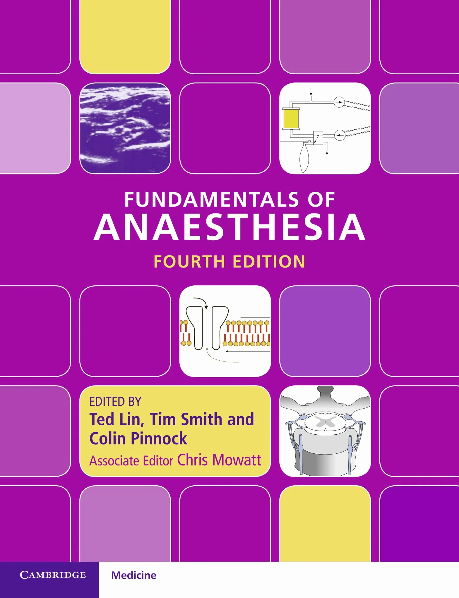 Fundamentals of Anaesthesia