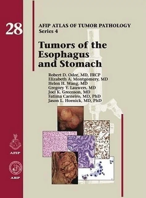 Tumors of the Esophagus and Stomach: No. 28