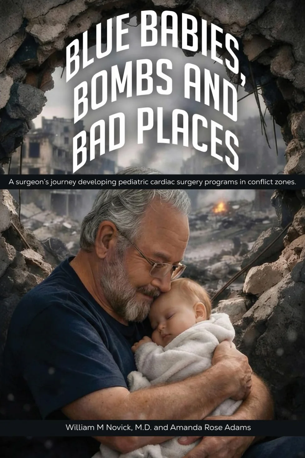 Blue Babies, Bombs and Bad Places: A surgeon’s journey developing pediatric cardiac surgery programs in conflict zones. Authors William M Novick, M.D. and Amanda Rose