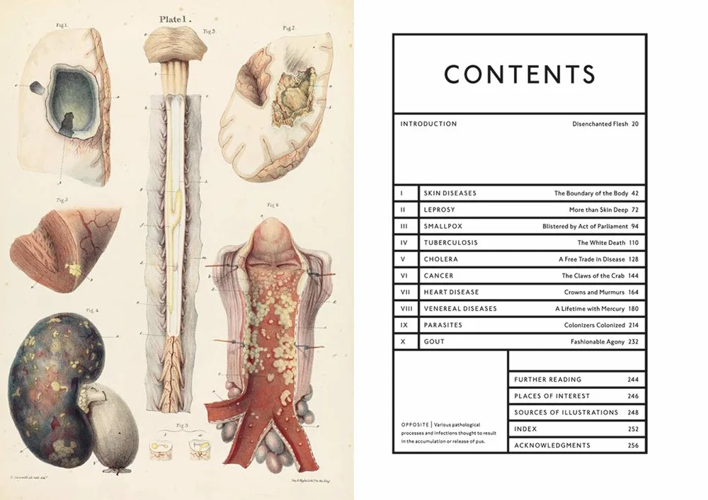 The Sick Rose Disease and the Art of Medical Illustration /anglais
