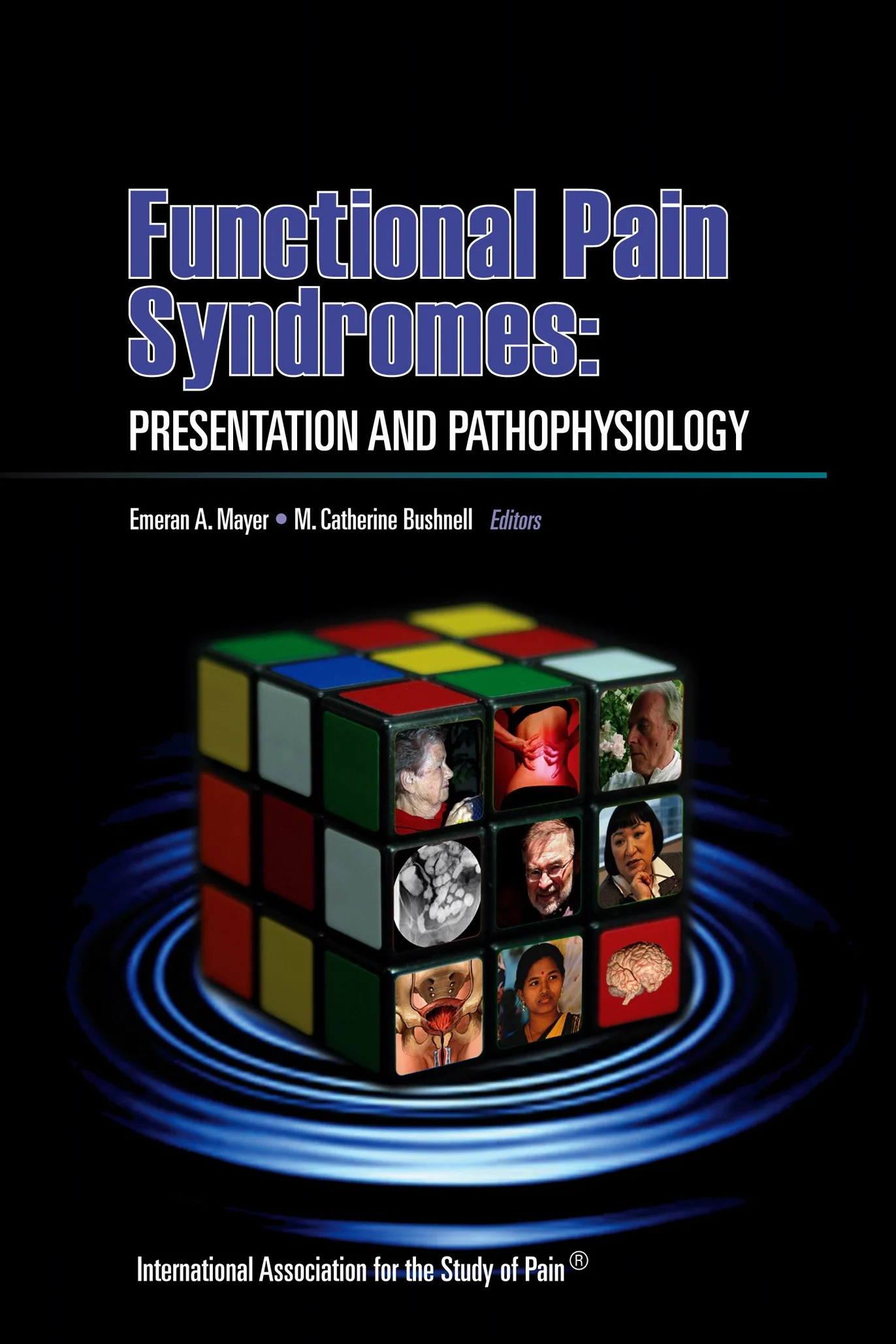 Functional Pain Syndromes: Presentation and Pathophysiology