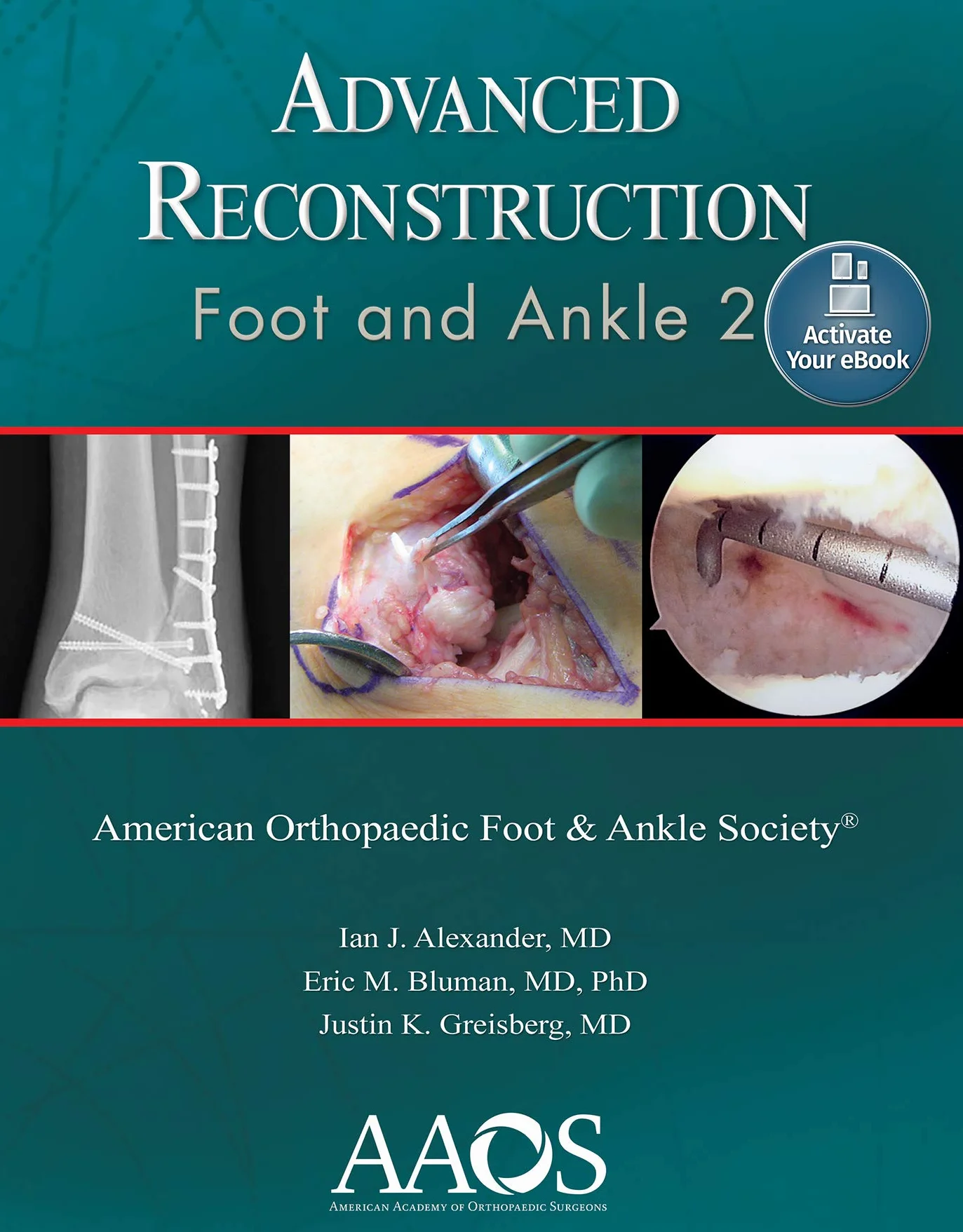 Advanced Reconstruction: Foot and Ankle 2: Print + eBook